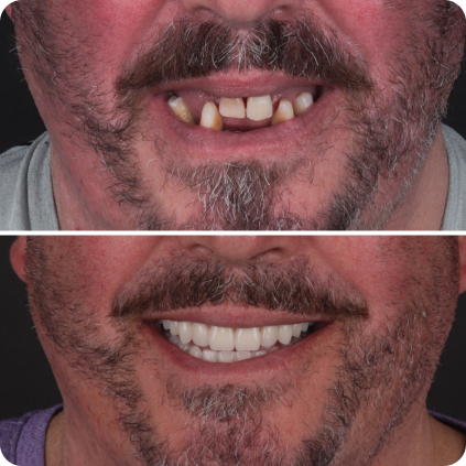 Casos clinicos site-09 1