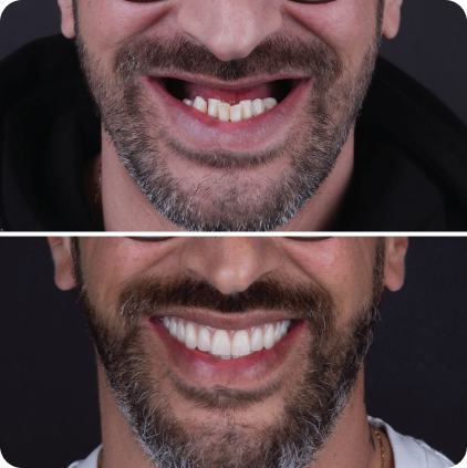 Casos clinicos site-10 1