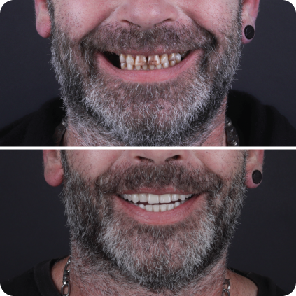 Casos clinicos site-13 1