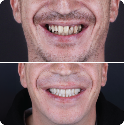 Casos clinicos site-16 1