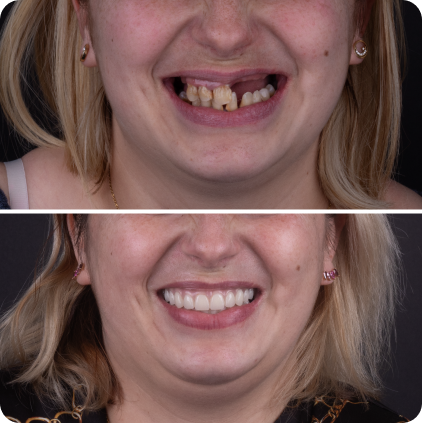 casos clinicos site02-04 1