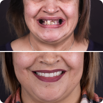 casos clinicos site02-10 1