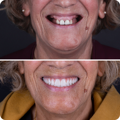 casos clinicos site02-13 1